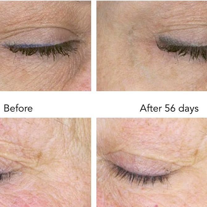 DNA-42 Clinicalift Serum™