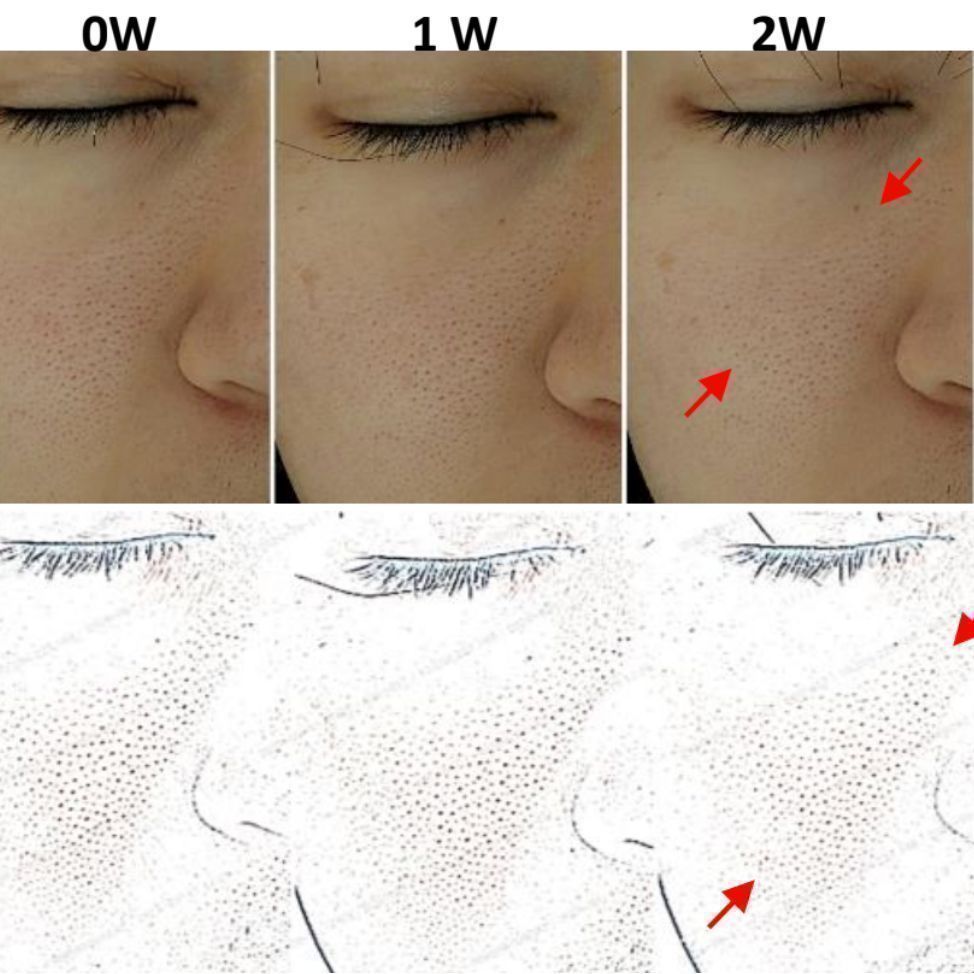 DNA-42 Clinicalift Serum™