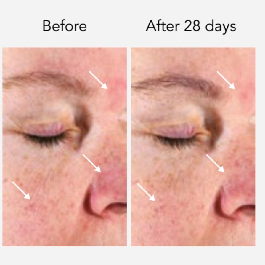 DNA-42 Clinicalift Serum™