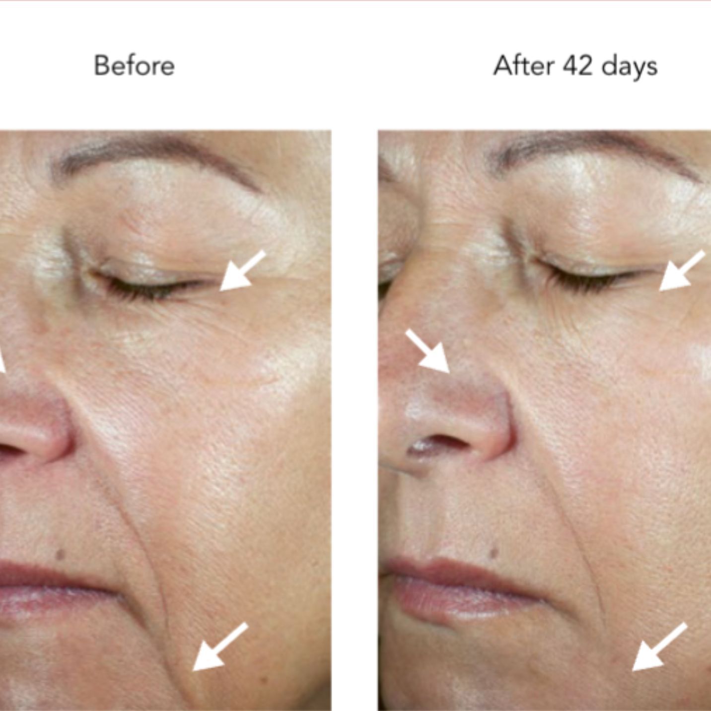 DNA-42 Clinicalift Serum™
