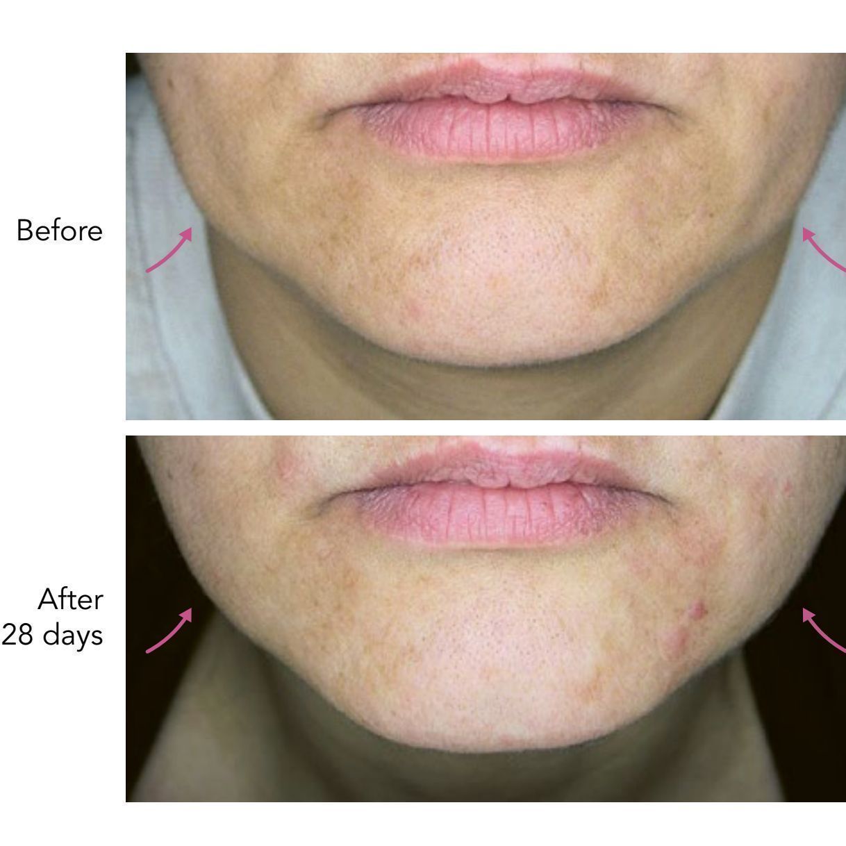 DNA-42 Clinicalift Serum™